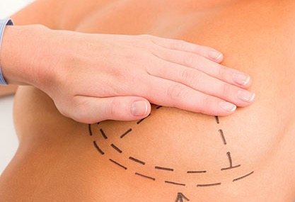 Методы увеличения груди