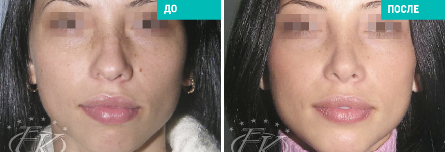 Исправление профиля