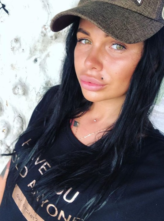 Александра Шева до пластики и после: фото