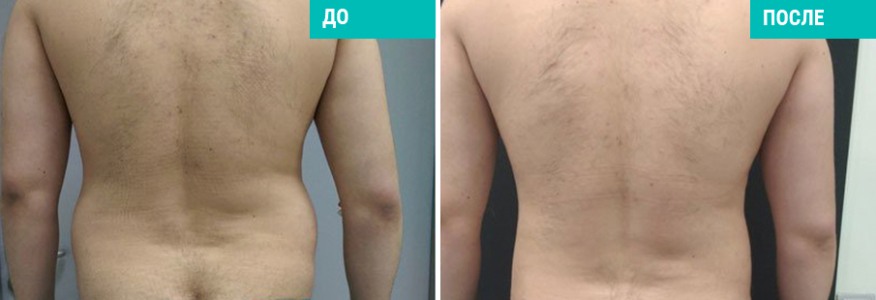 Васер для мужчин