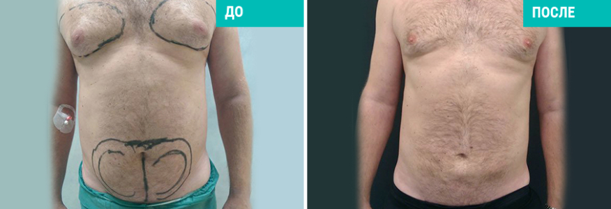 Васер для мужчин