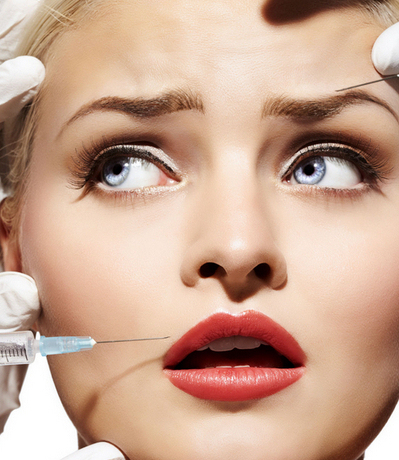 Что такое филлеры в косметологии?