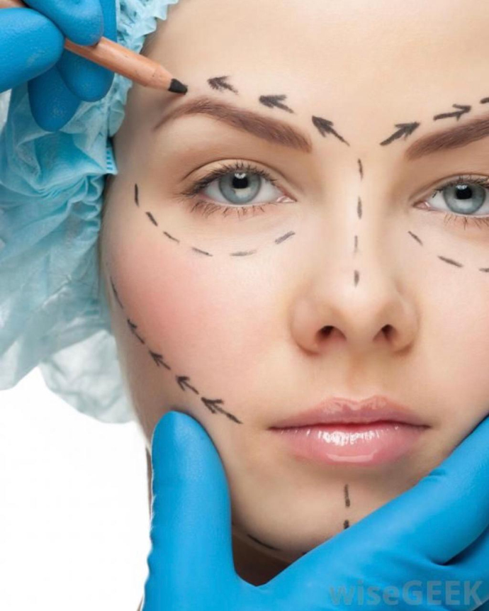 Кантопексия и кантопластика: избавляемся от «гусиных лапок»