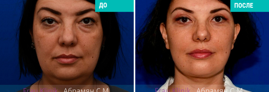 Имиджевая пластика