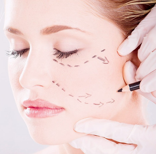 Рубцы после пластики лица