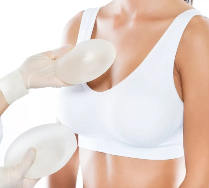 Какие бывают импланты?