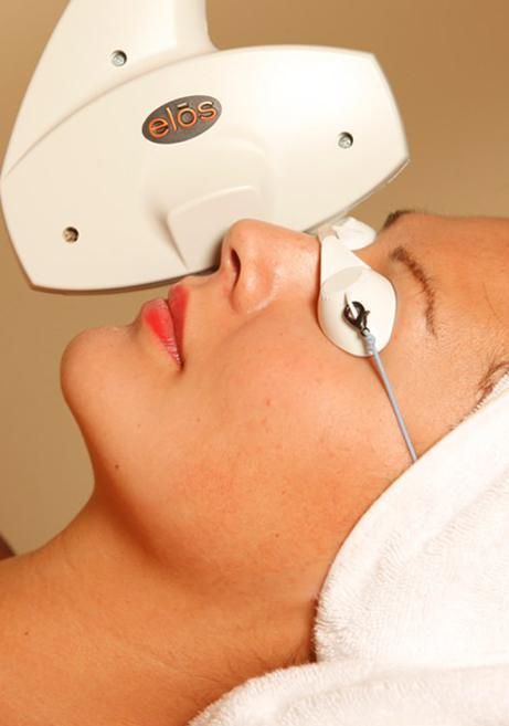 Новинки косметологии: элос-омоложение