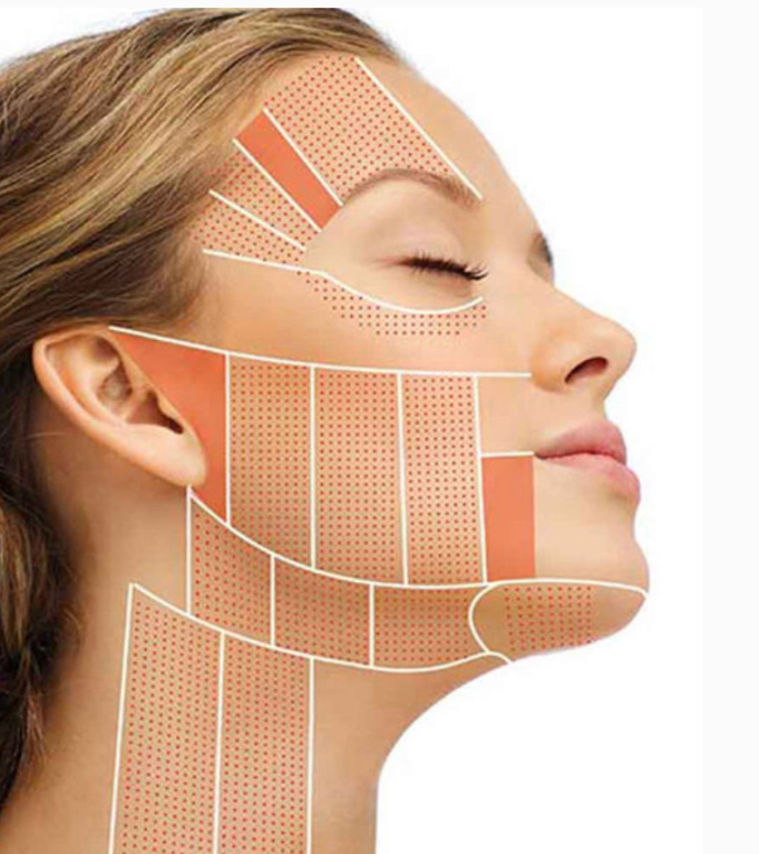 SMAS-лифтинг DOUBLO