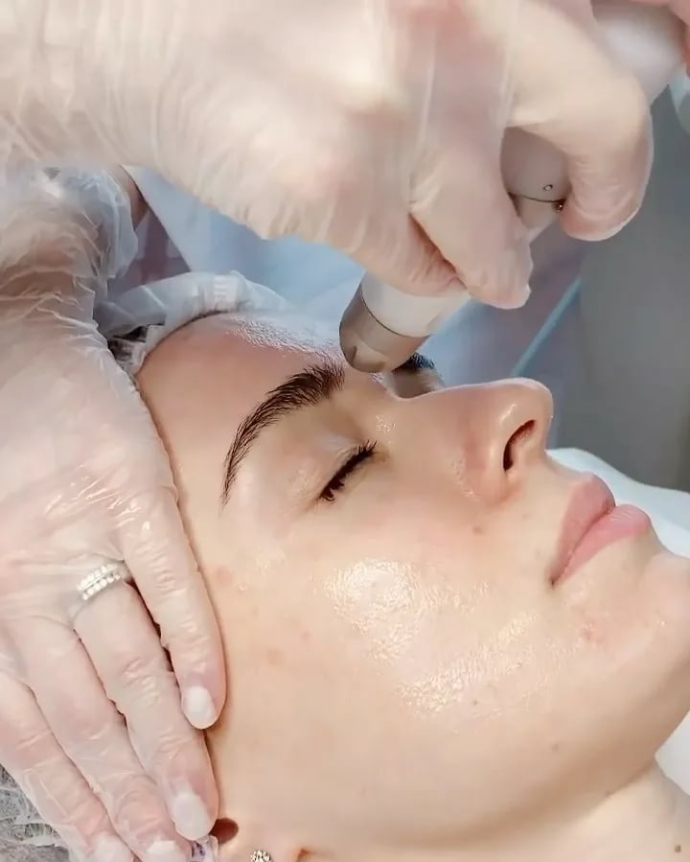 DermaDrop: безинъекционная мезотерапия
