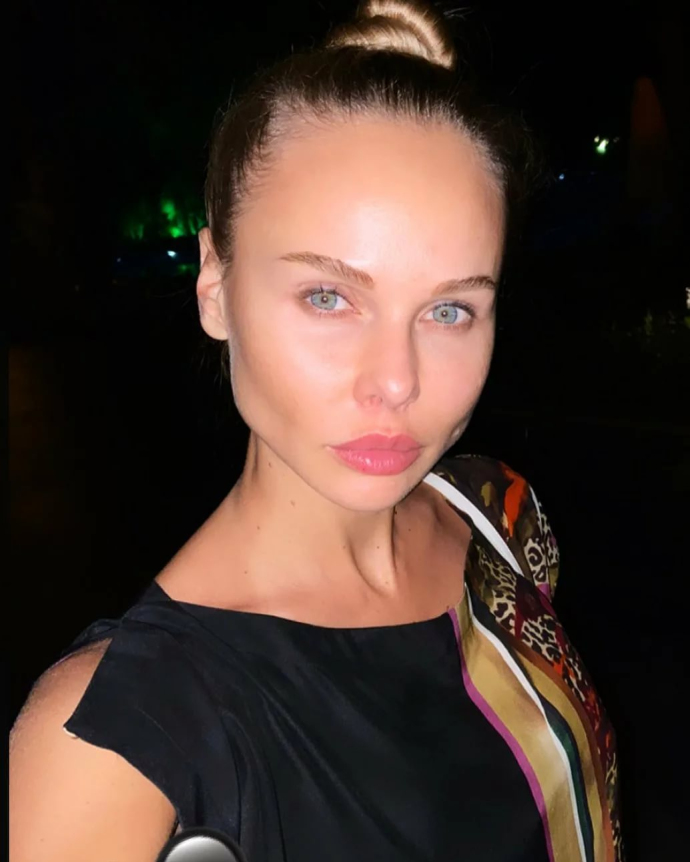 Надежда Санько до и после пластики