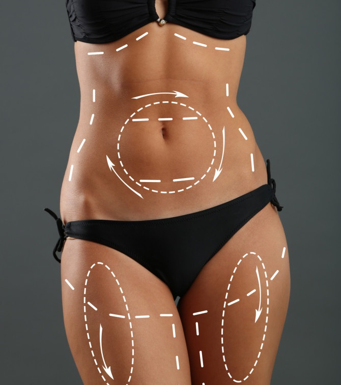 Как избавиться от жировых ловушек?