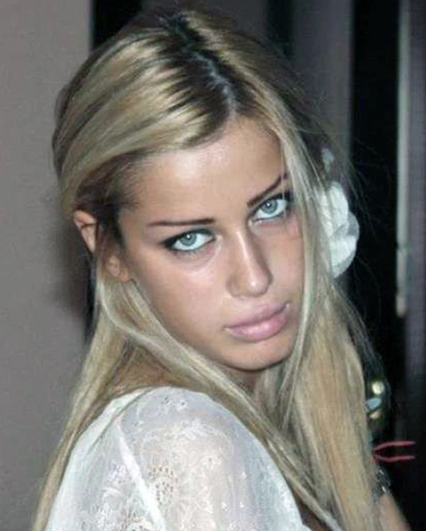 Миранда Шелия до и после пластики