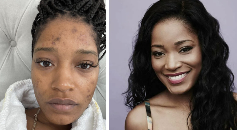 Фото Кеке Палмер