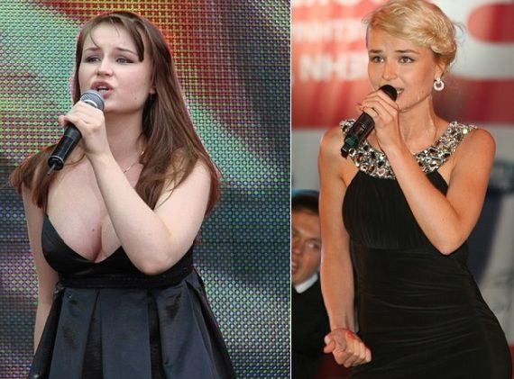 Фото: Полина Гагарина до и после похудения