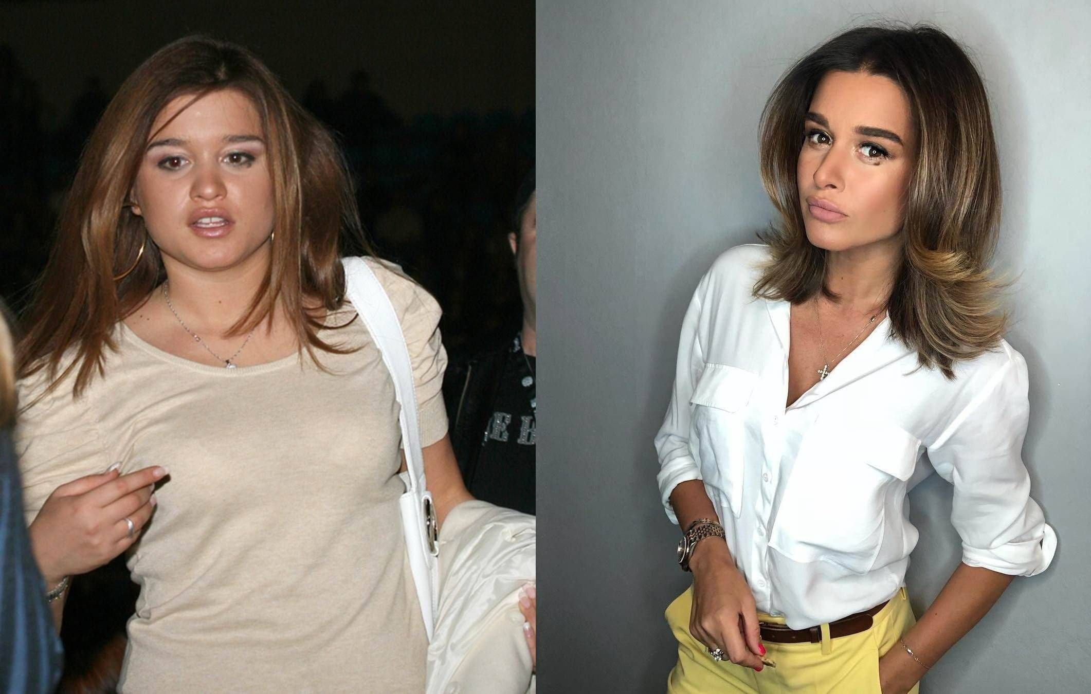 Фото: Ксения Бородина до и после похудения