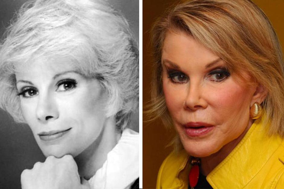 Фото: Джоан Риверз