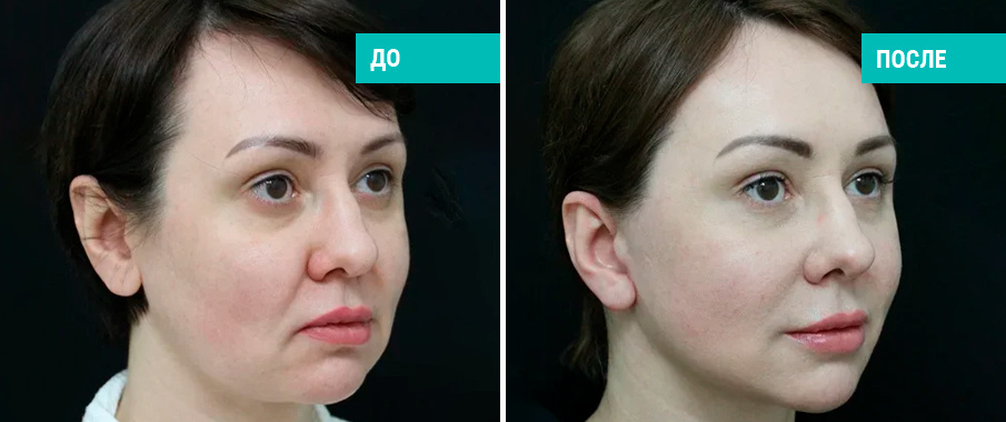 Пластический хирург В. Э. Кобазев