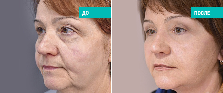 Пластический хирург А. Н. Ковынцев