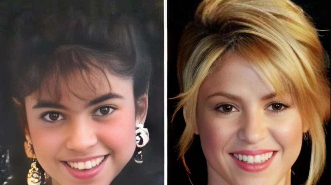 До и после пластики носа