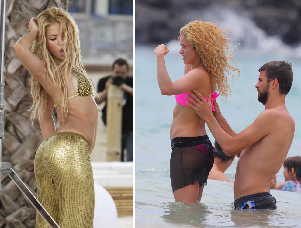 До и после подтяжки живота