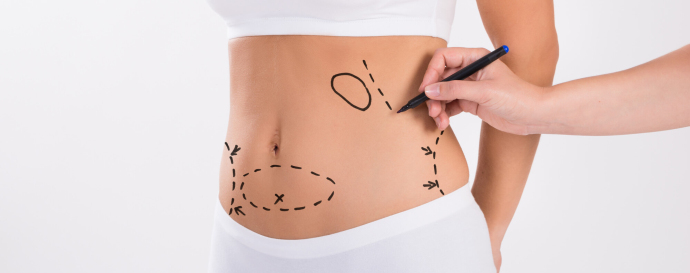 До и после липосакции