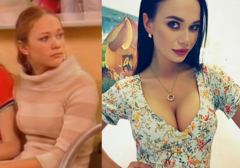 Яна Кошкина до и после пластики