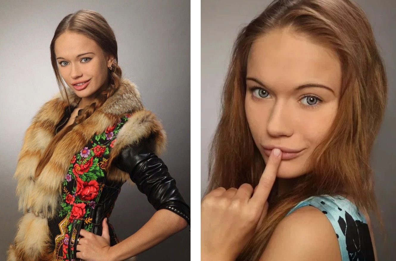 Яна Кошкина до пластики