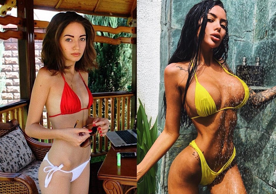 Алена Омович до и после пластики