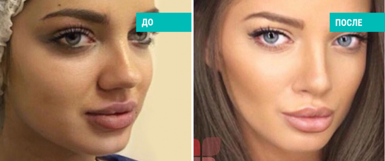 Пластический хирург Ю. С. Васильева