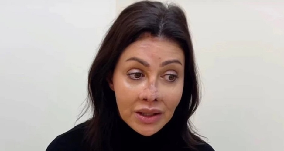 После операции