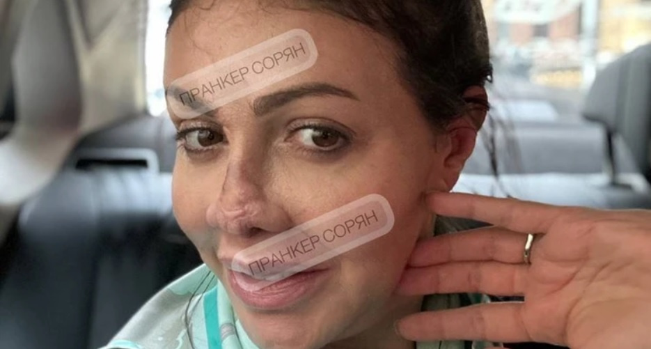 После операции