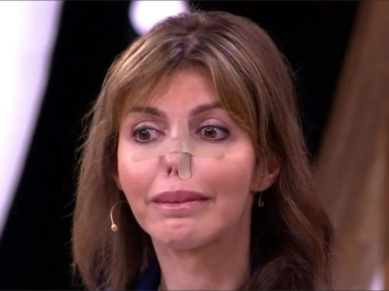 До операции