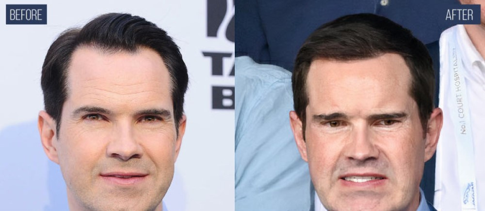 Фото: Джимми Карр