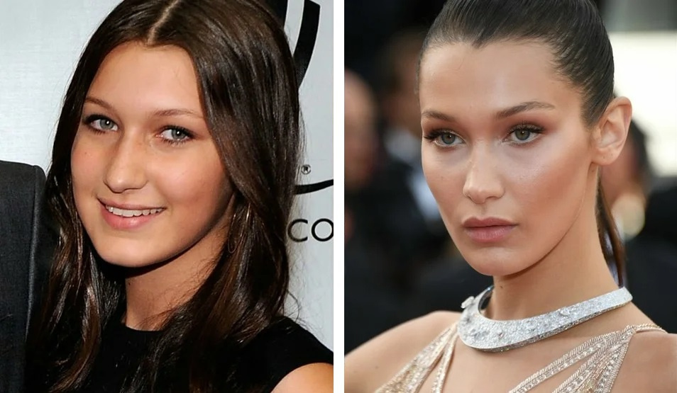 Белла Хадид до и после