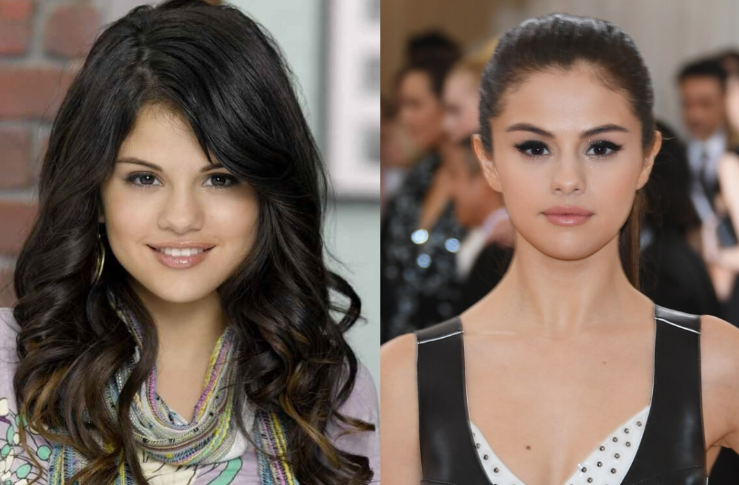 Пластика лица