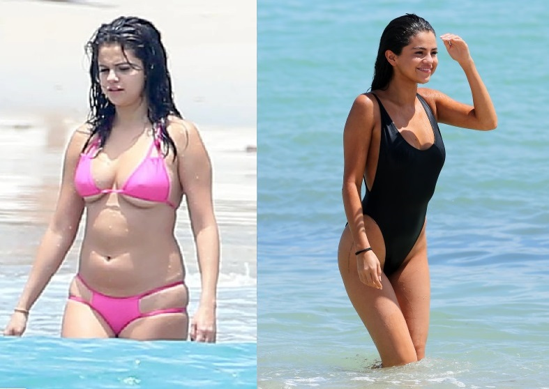 До и после похудения