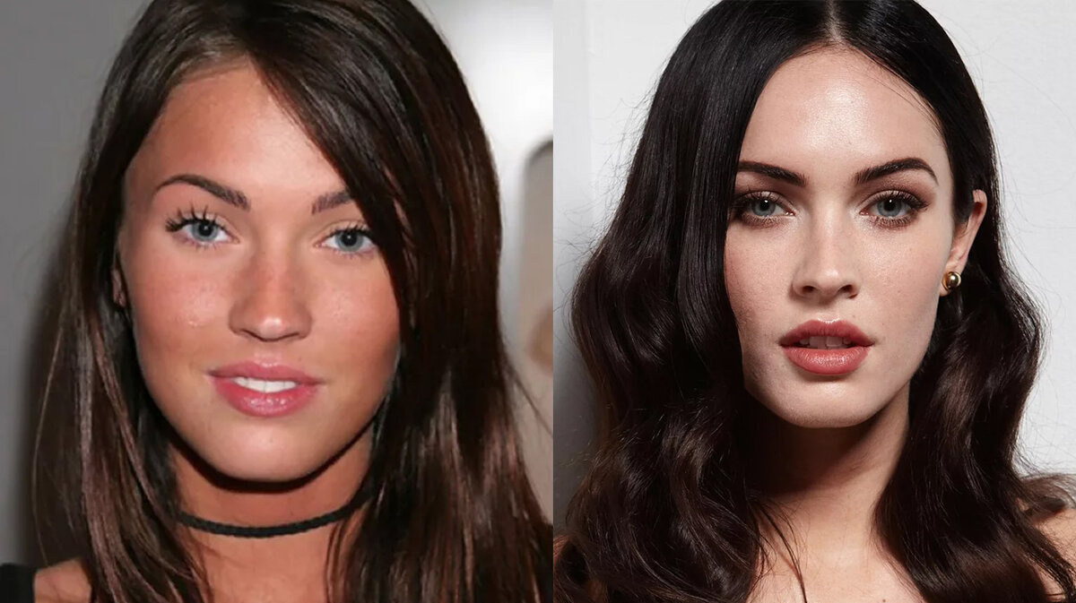 Фото: Меган Фокс до и после ринопластики