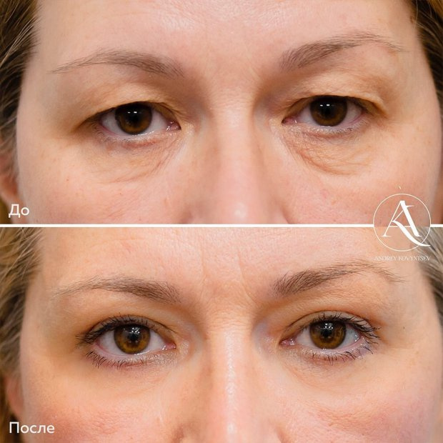 Пластичексий хирург А. Н. Ковынцев