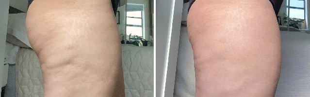 Фото до и после. Источник фото: www.allure.com