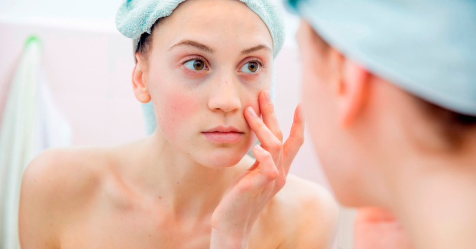 Продукты, которые могут помочь уменьшить темные круги под глазами