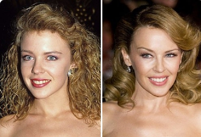 Фото: Кайли Миноуг