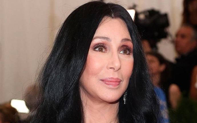 Шер до и после пластики