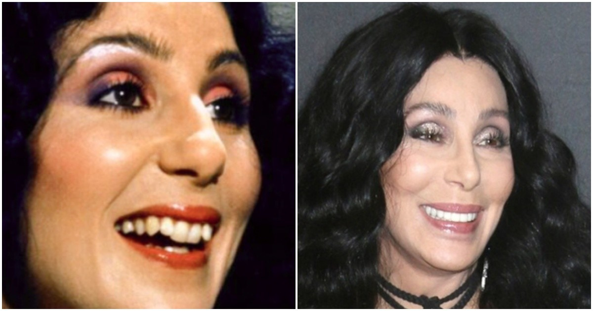 Фото: Шер в молодсти и сейчас