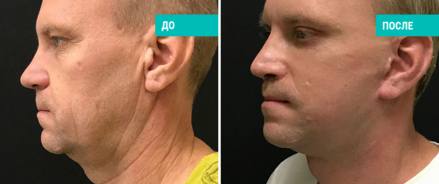 Пластический хирург О. А. Ованесова