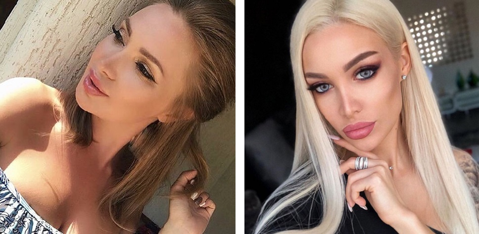 Фото после окончания реабилитации. Пластический хирург Г. П. Бабаян