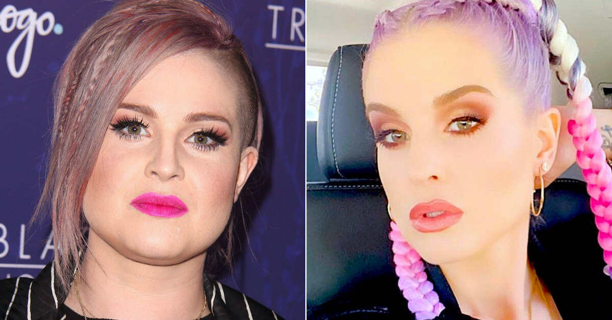 Фото: Келли Осборн до и после пластики