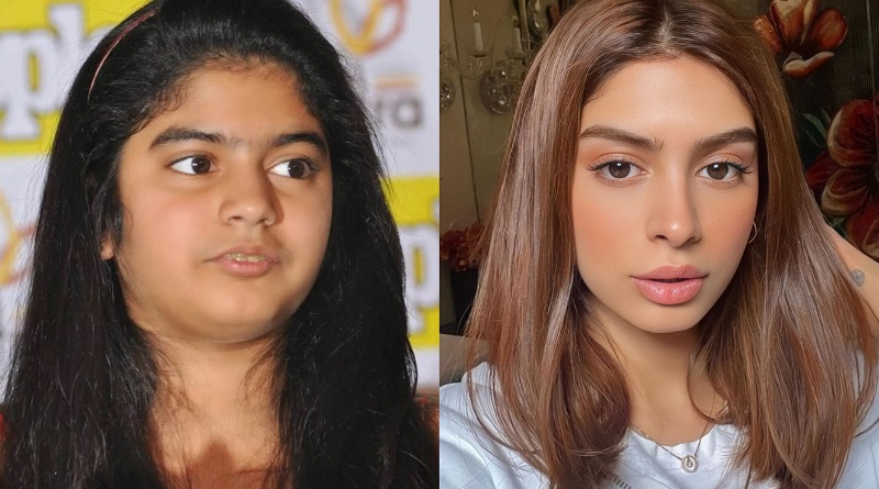 Фото: Кхуши Капур до и после пластики