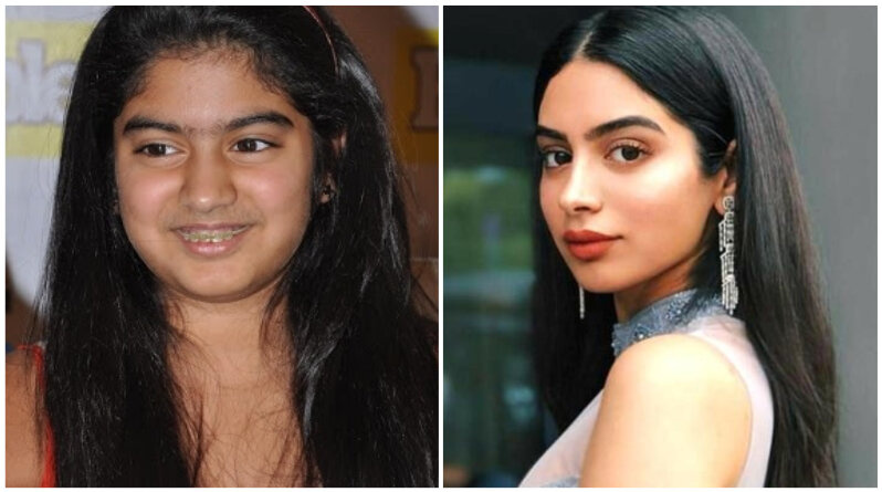 Фото: Кхуши Капур до и после пластики