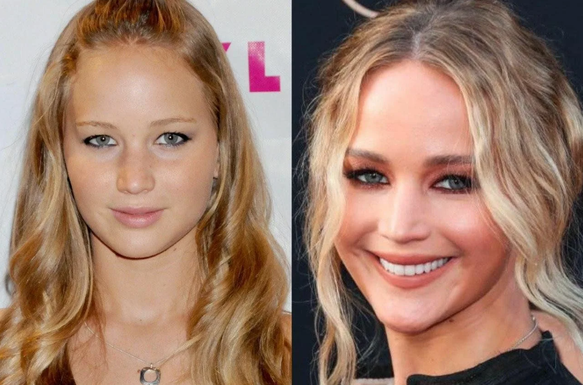 Фото: Дженнифер Лоуренс