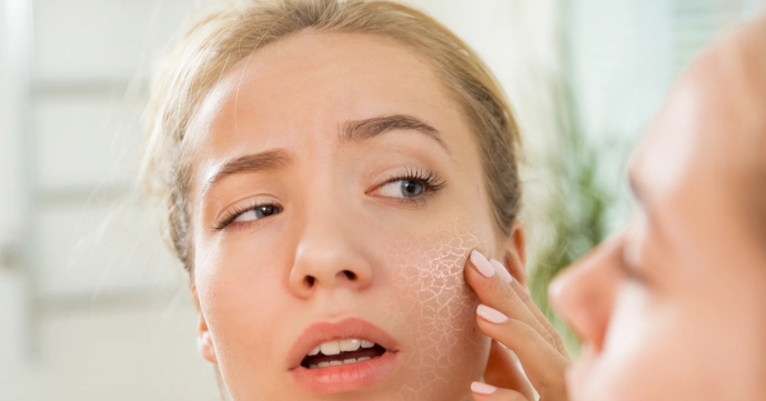 Как увлажнить сухую кожу зимой